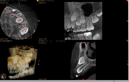 どんな画像が映し出されるの？