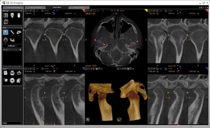 どんな画像が映し出されるの？